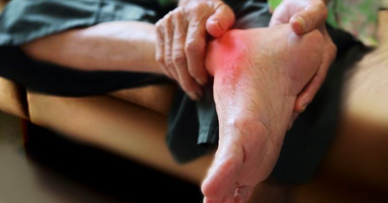 artrosi piede