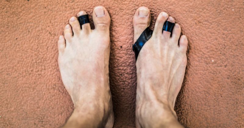 protesi alluce valgo