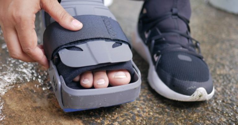 Scarpa post intervento